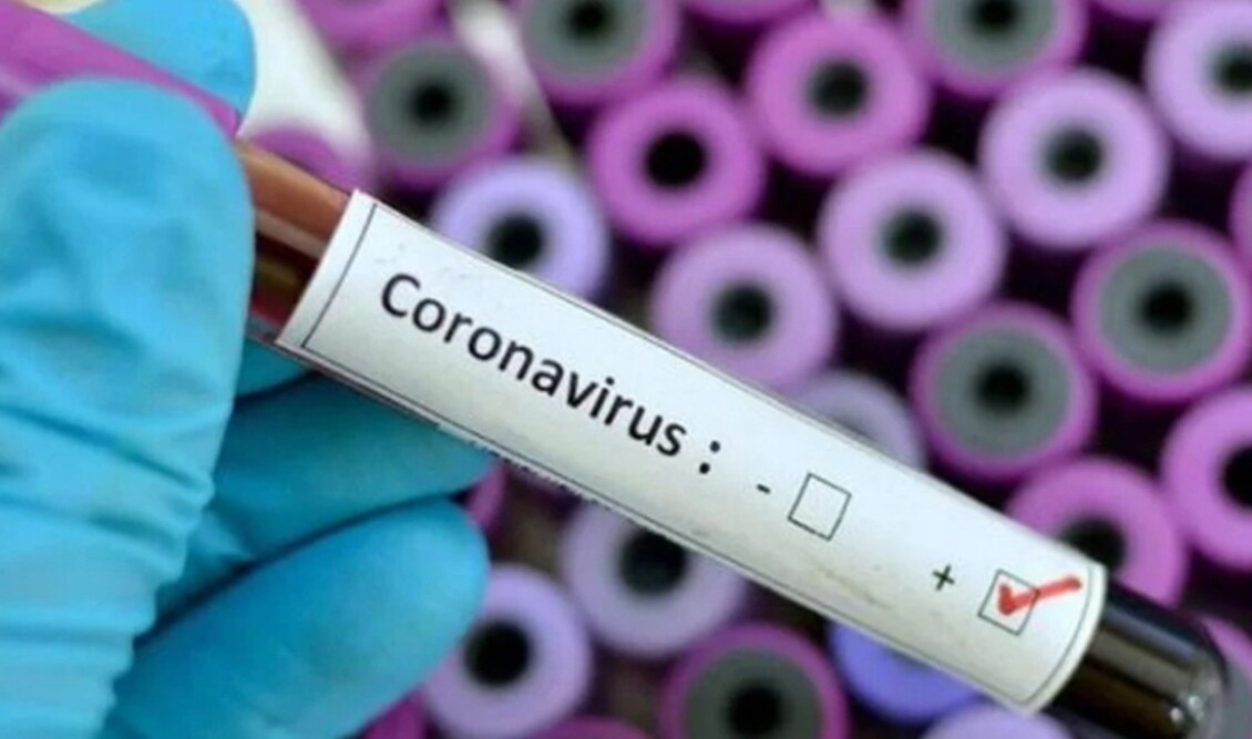 coronavirus-1