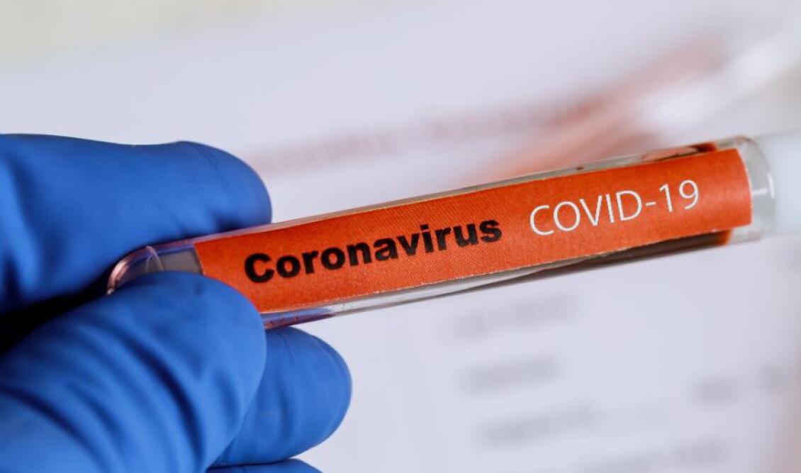coronavirus-koronoios