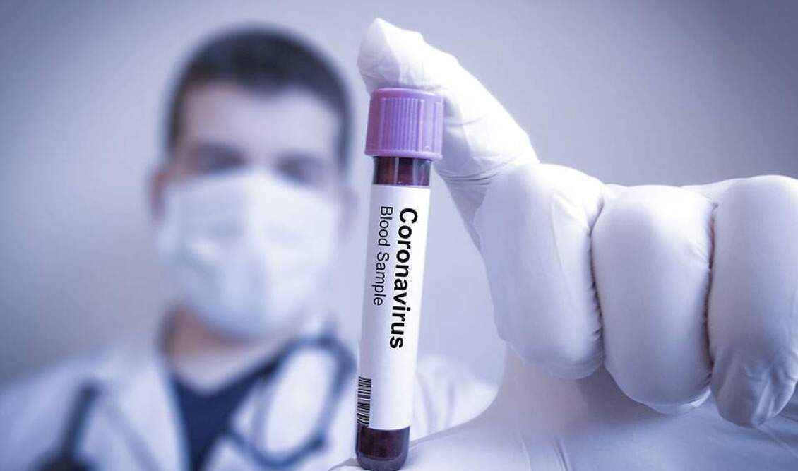 coronavirus-test-thumb-large--2-thumb-large--2-thumb-large