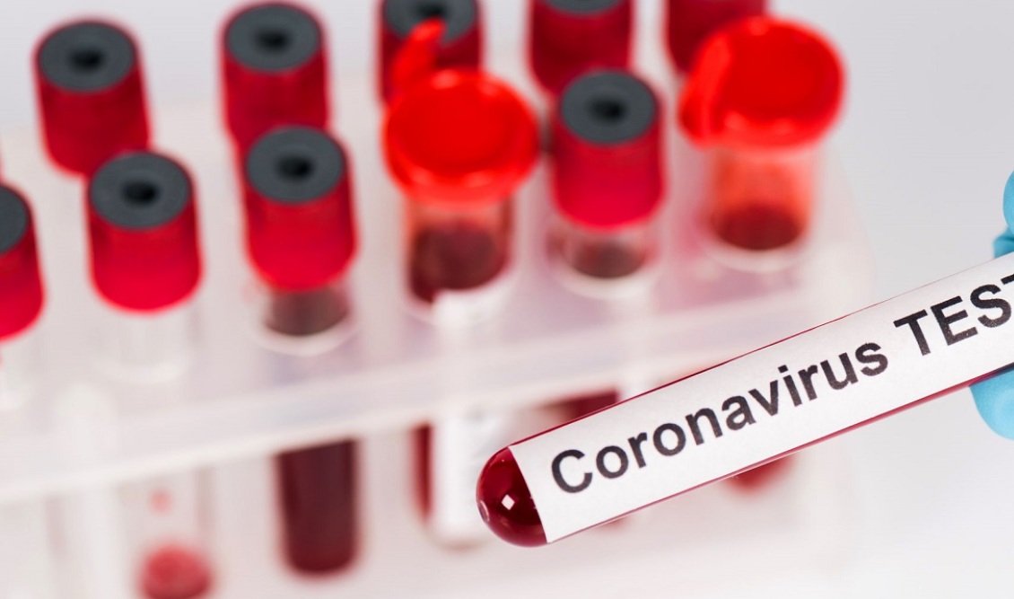 coronavirus_test
