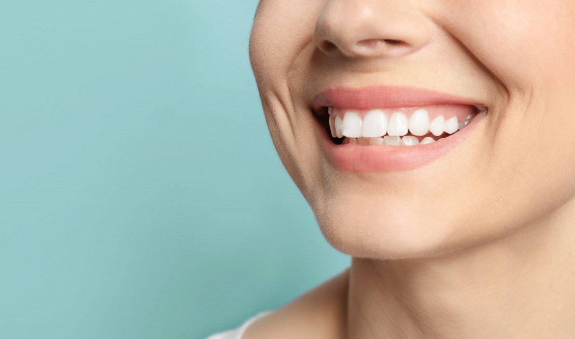 teeth-whitening-