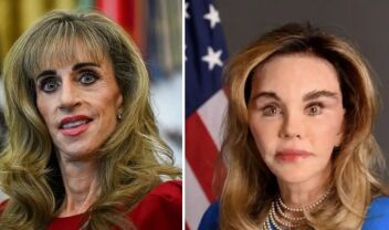 Τι είναι το ''Mar-a-Lago face'': Ο όρος που έγινε viral 